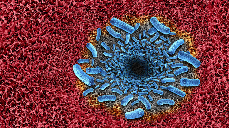 Image rendering of flesh eating bacteria